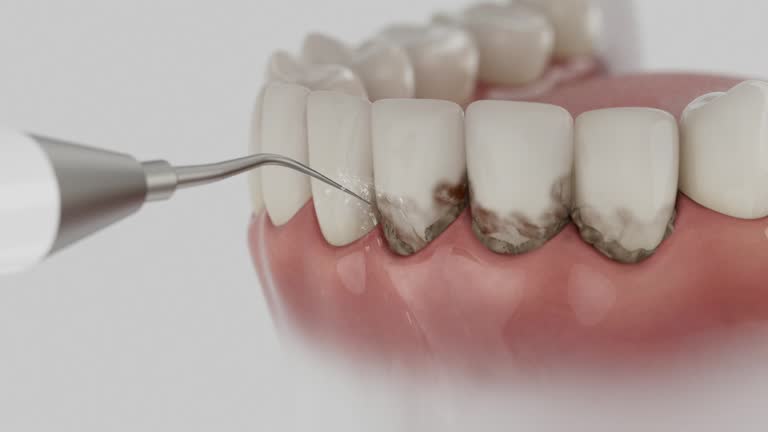 Reliable Dental Implants contractor in St. Joseph, MI by Smile Center Dentistry